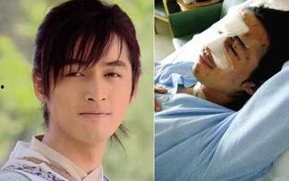 娱乐圈车祸爆料,惊心动魄的瞬间与幕后真相